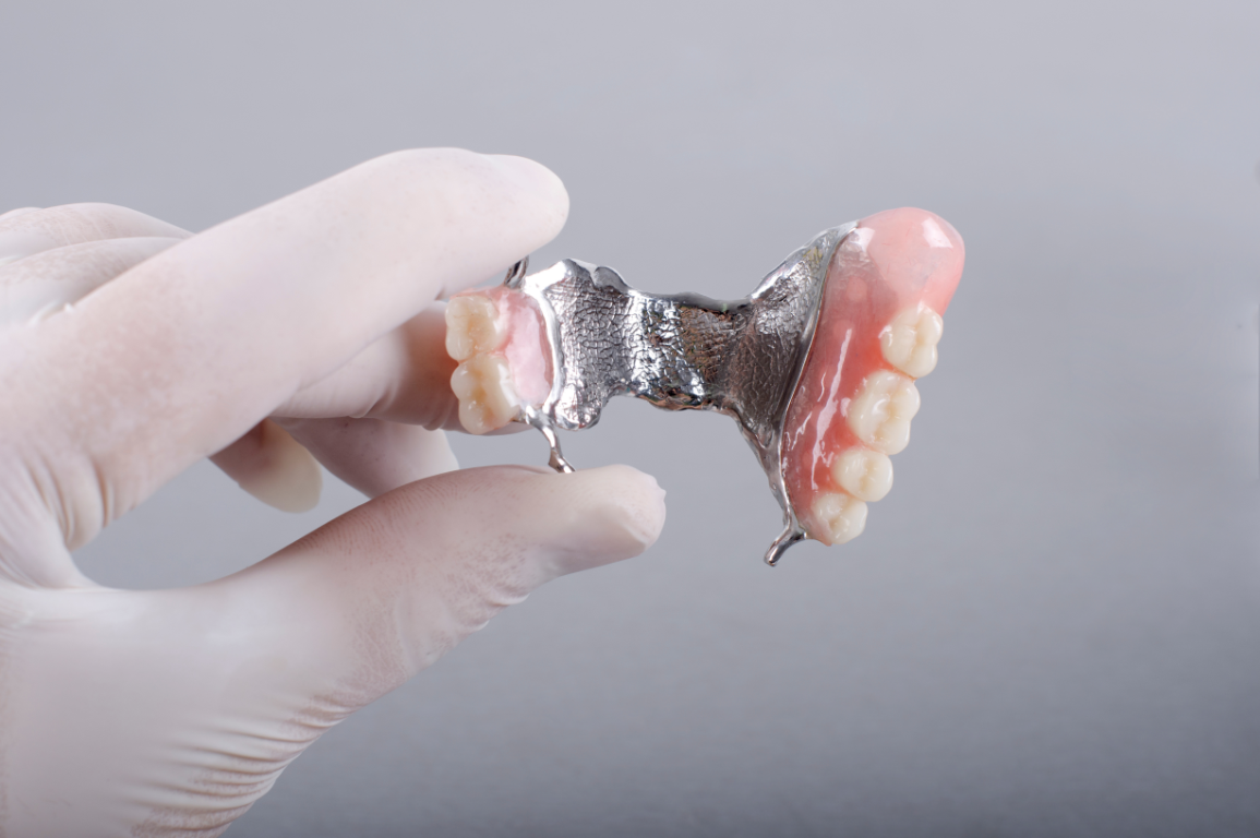 Denturly Chrome Dentures